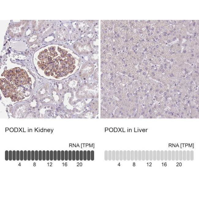 PODXL Antibody