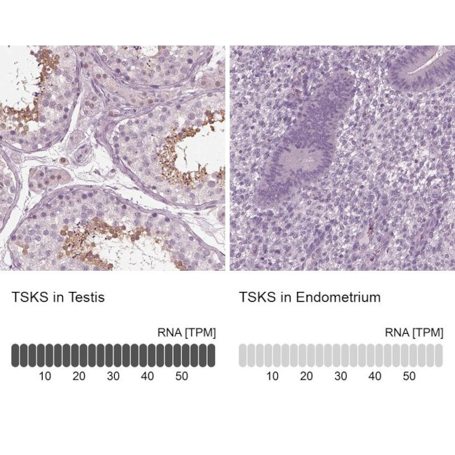 TSKS Antibody