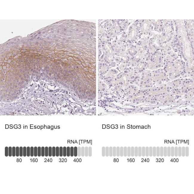 Desmoglein 3 Antibody