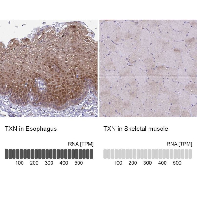 Thioredoxin 1 Antibody