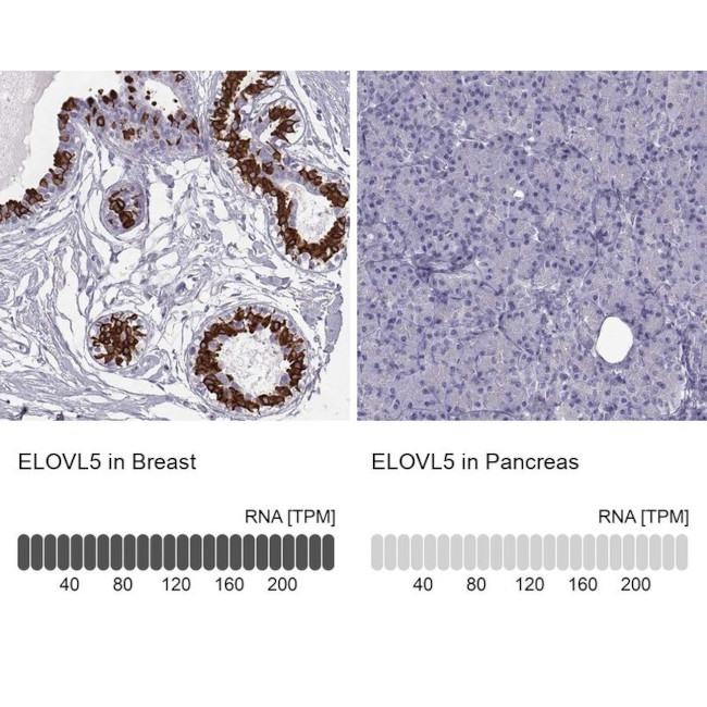 ELOVL5 Antibody