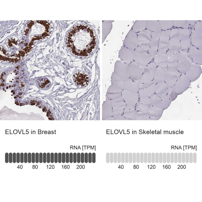 ELOVL5 Antibody