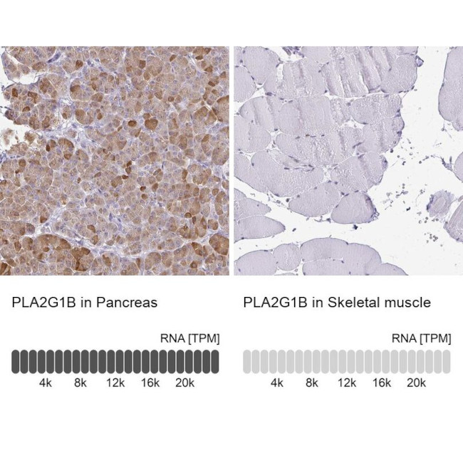 PLA2 Antibody