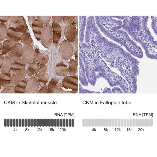 Creatine Kinase MM Antibody