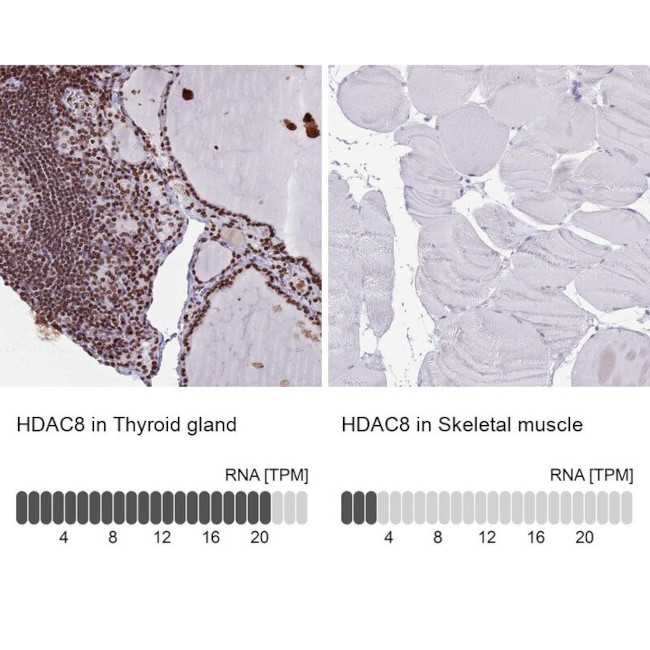 HDAC8 Antibody