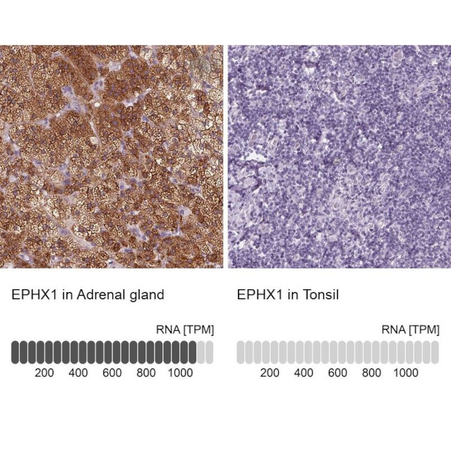 EPHX1 Antibody