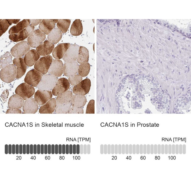 CaV1.1 Antibody