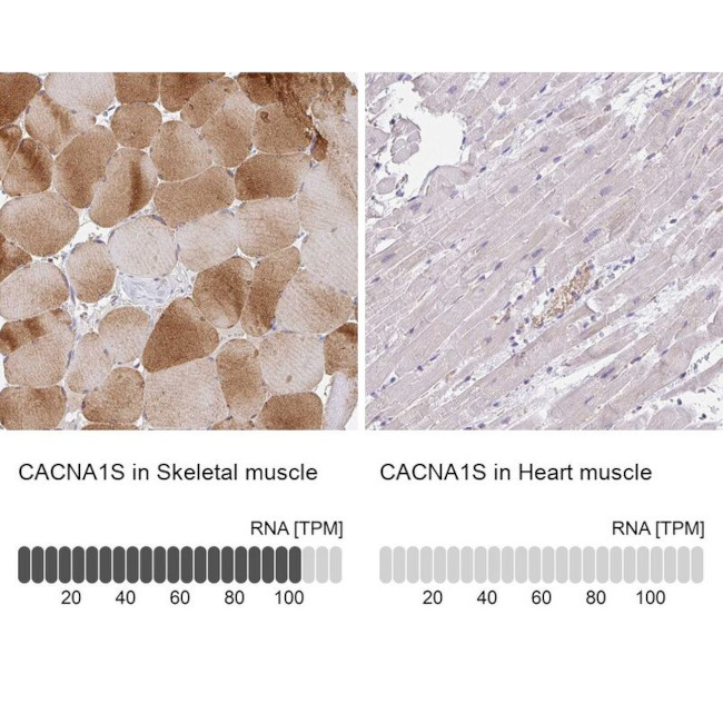 CaV1.1 Antibody