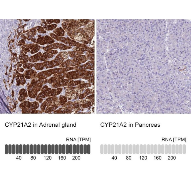 CYP21A2 Antibody