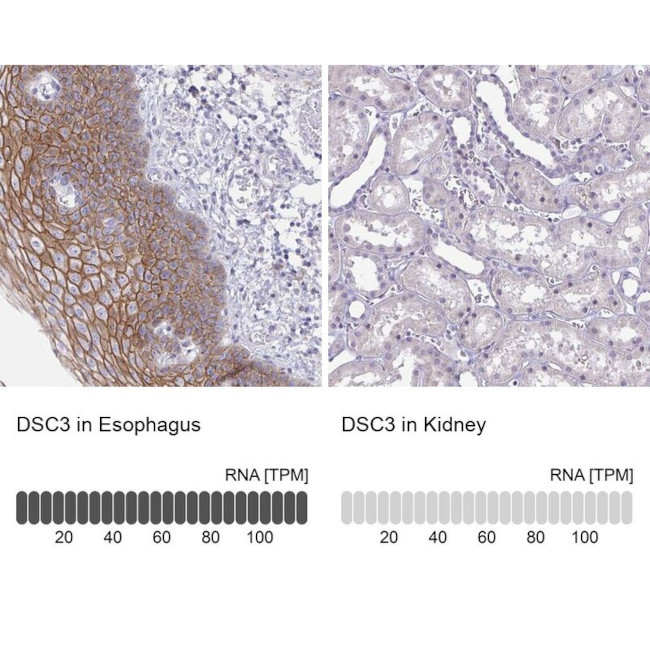 Desmocollin 3 Antibody