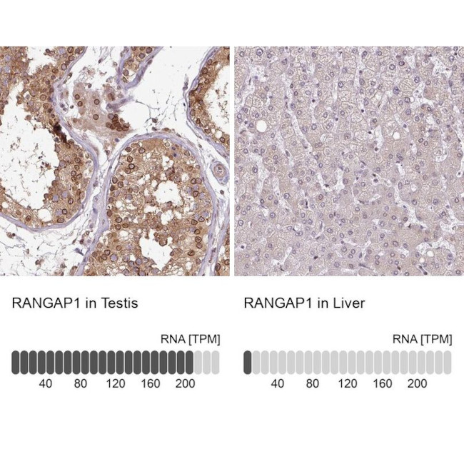 RANGAP1 Antibody