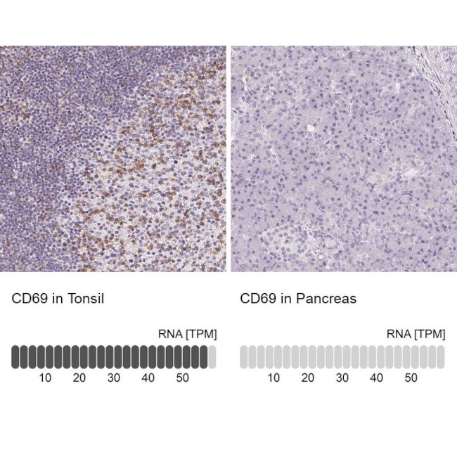 CD69 Antibody