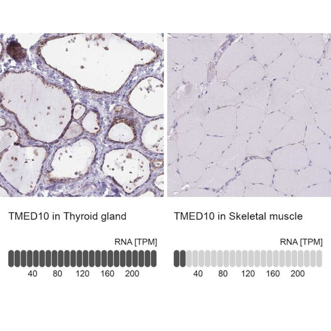 TMP21 Antibody