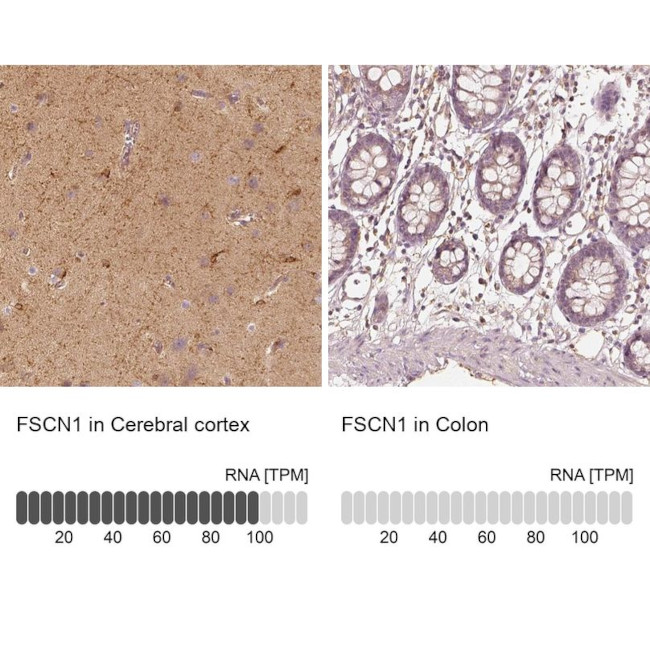 Fascin Antibody