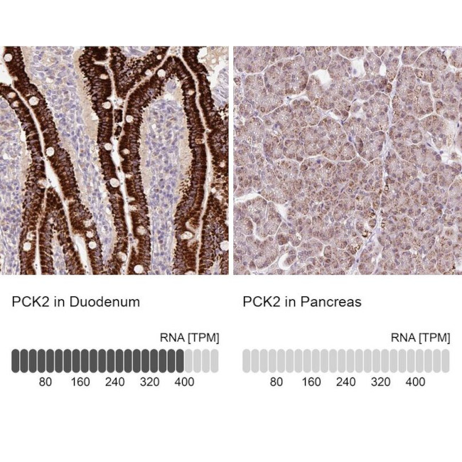 PCK2 Antibody