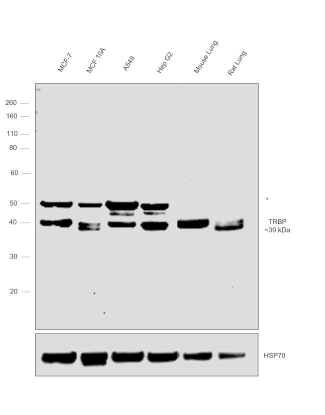 TRBP Antibody in Western Blot (WB)