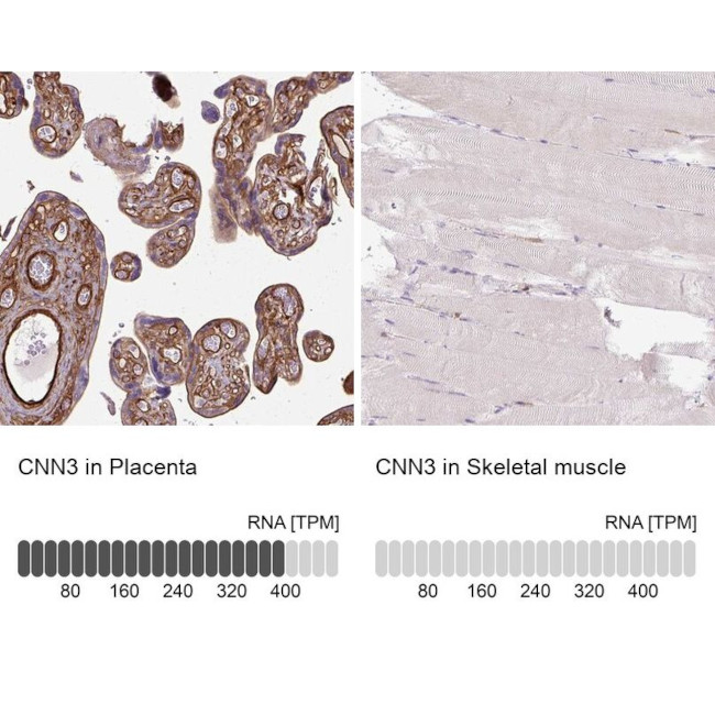 Calponin 3 Antibody