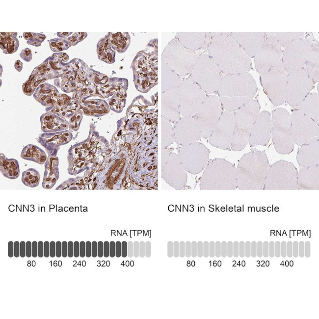 Calponin 3 Antibody