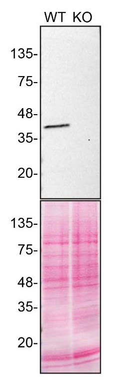 Calponin 3 Antibody in Western Blot (WB)