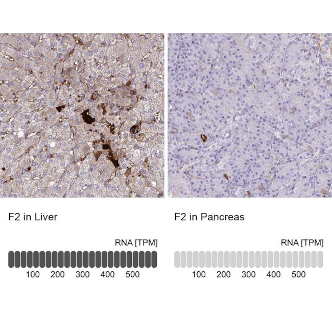 Prothrombin Antibody