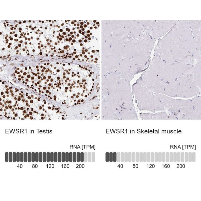 EWSR1 Antibody