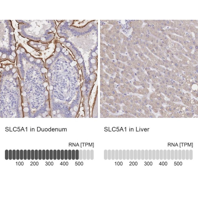 SGLT1 Antibody