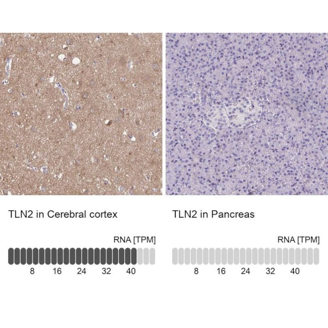 Talin 2 Antibody