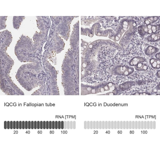 IQCG Antibody