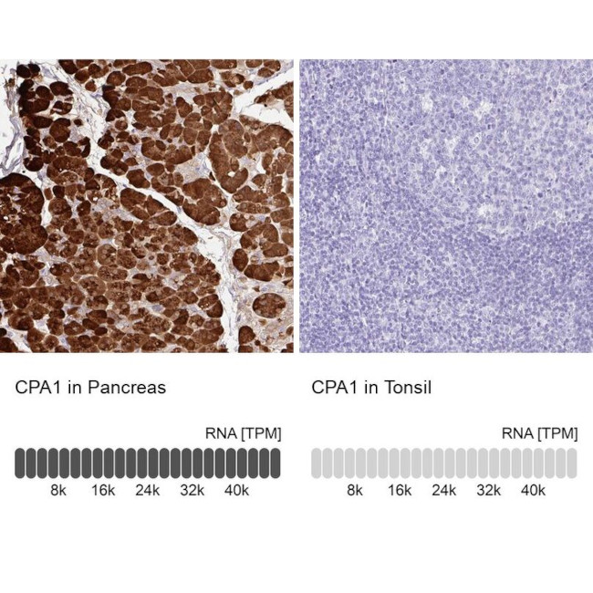 Carboxypeptidase A1 Antibody