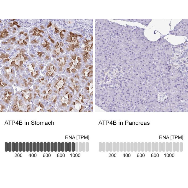 ATP4B Antibody