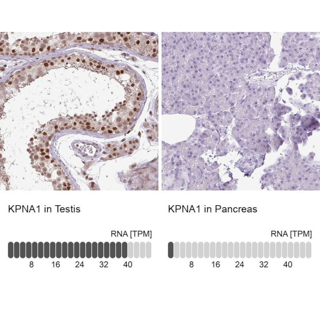 KPNA1 Antibody