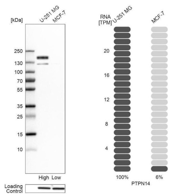 PTPN14 Antibody