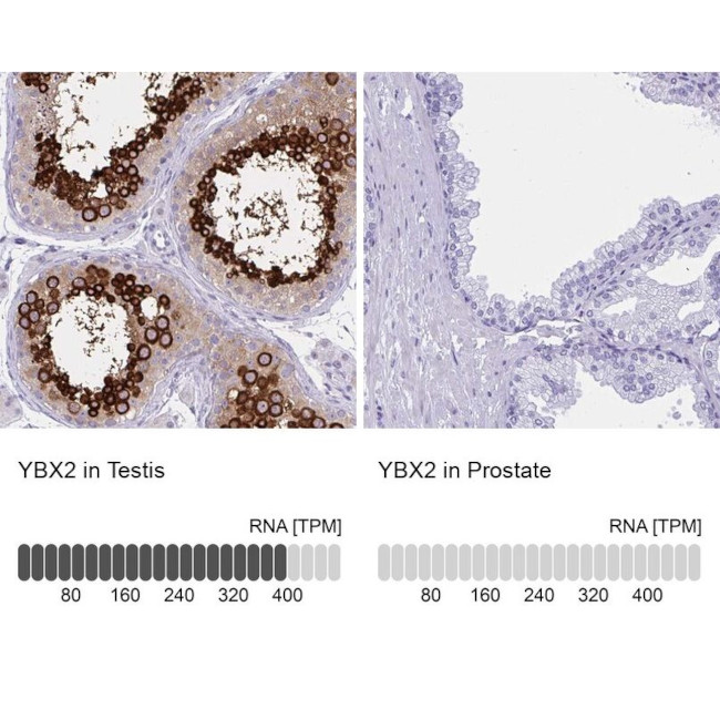 YBX2 Antibody