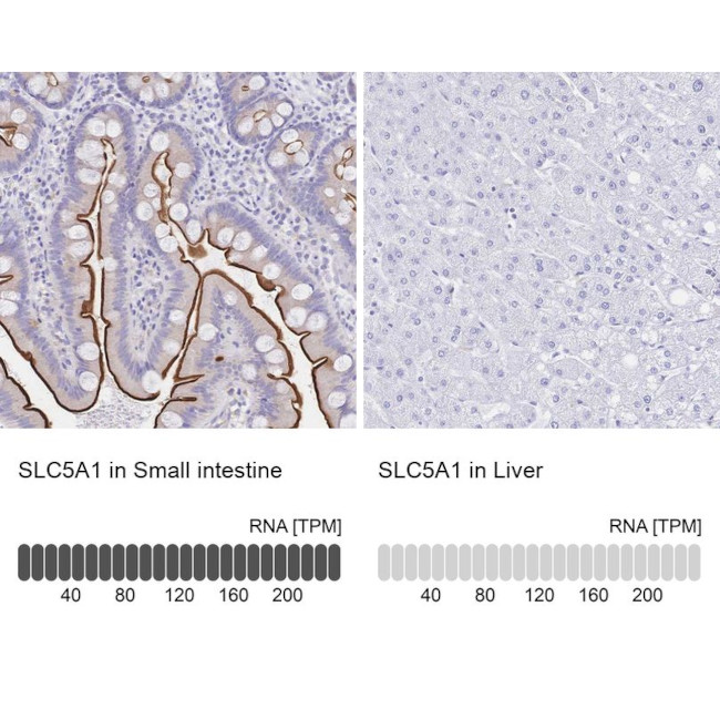 SGLT1 Antibody