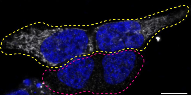 NDUFS2 Antibody in Immunocytochemistry (ICC/IF)