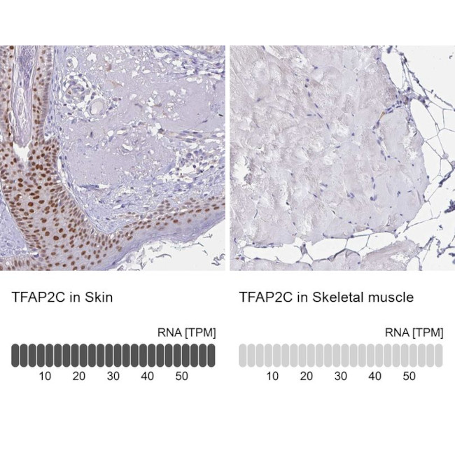 AP2 gamma Antibody