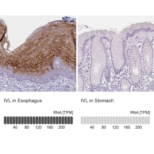 Involucrin Antibody