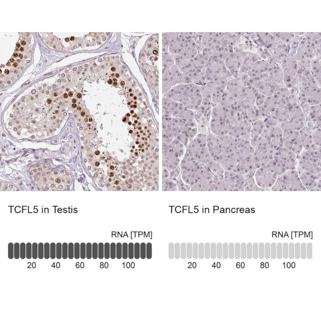 TCFL5 Antibody