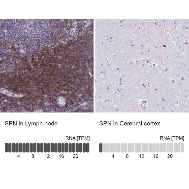 CD43 Antibody