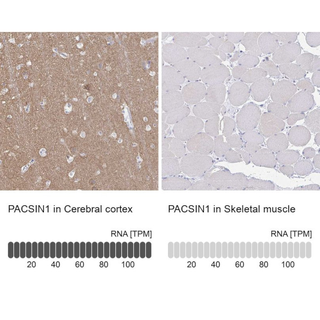 PACSIN1 Antibody