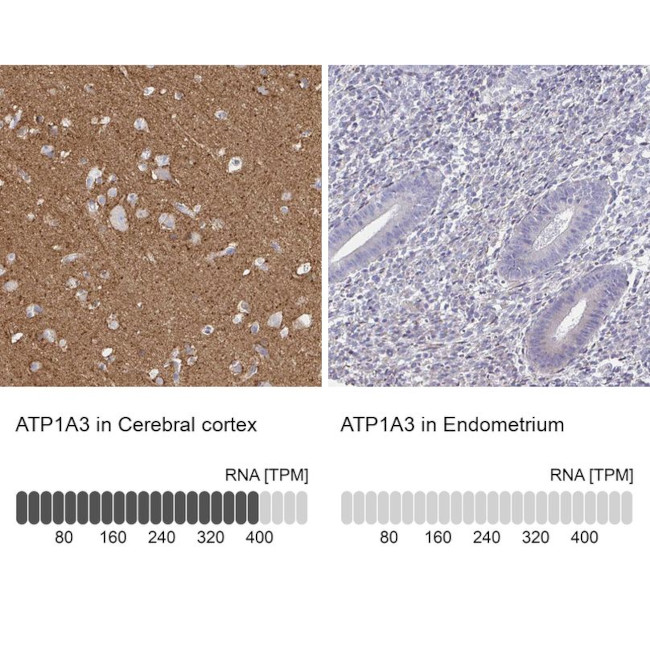 ATP1A3 Antibody