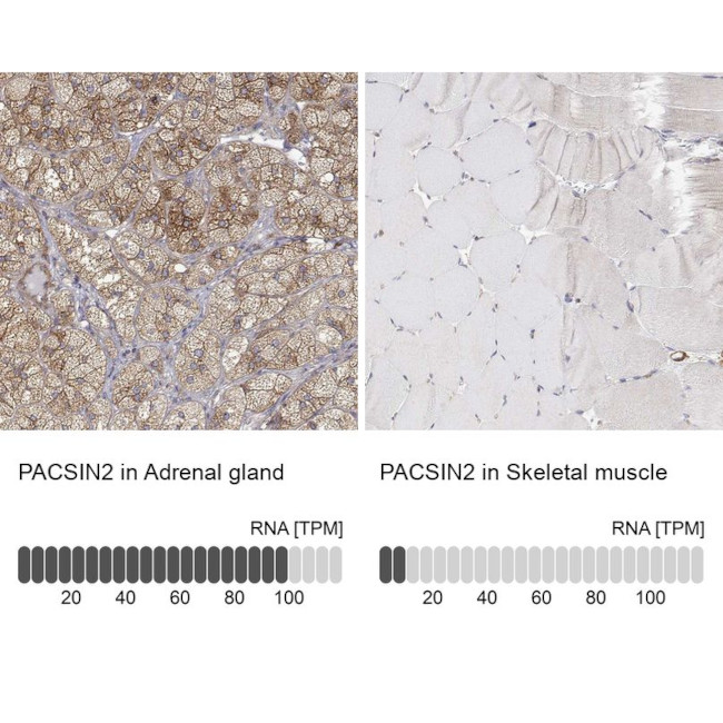 PACSIN2 Antibody