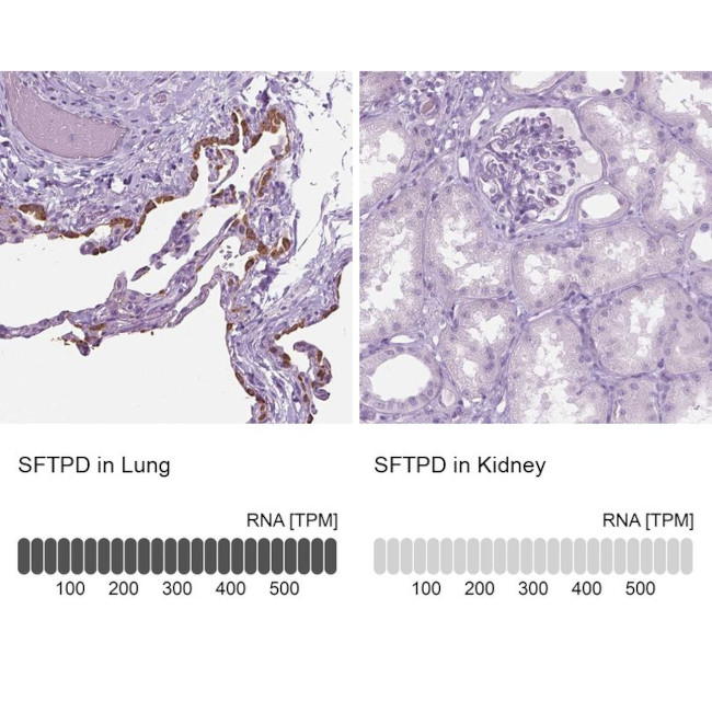 SFTPD Antibody