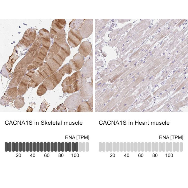 CaV1.1 Antibody