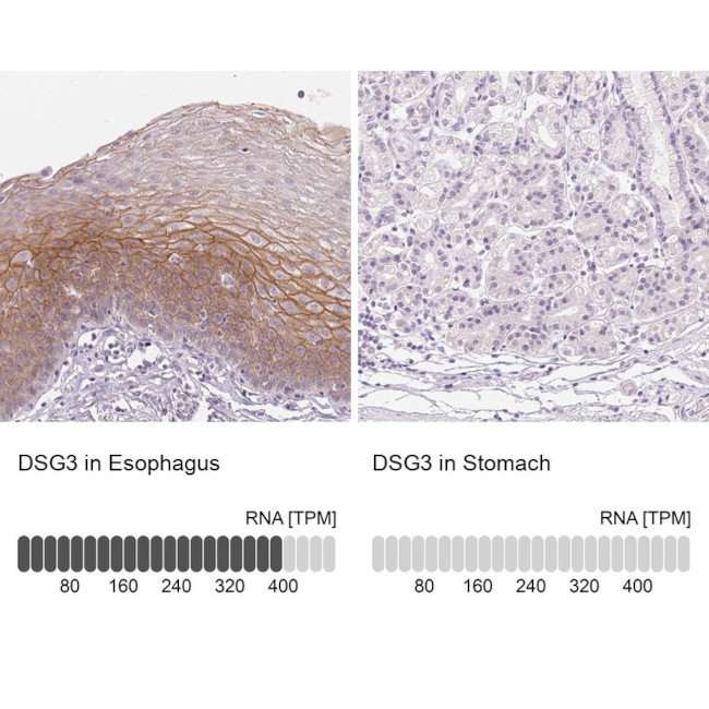 Desmoglein 3 Antibody