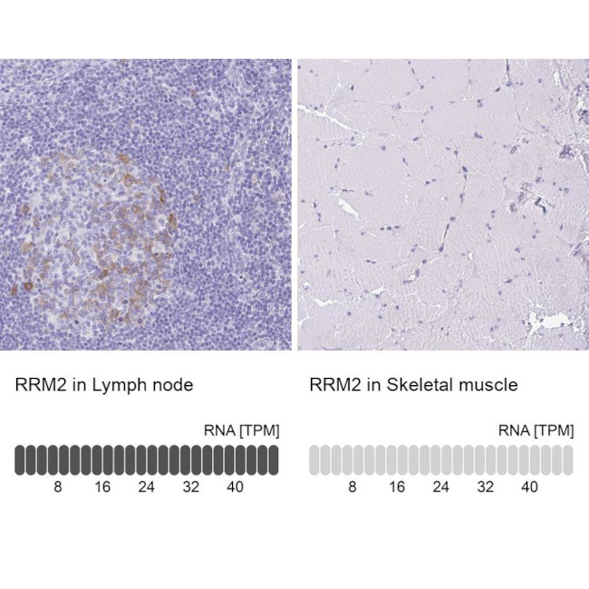 RRM2 Antibody