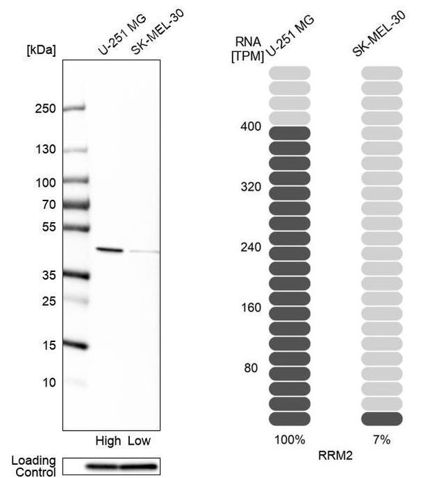 RRM2 Antibody