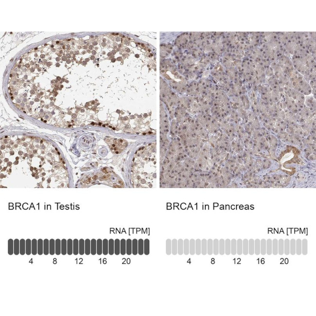 BRCA1 Antibody