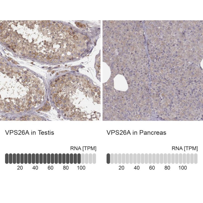 VPS26A Antibody