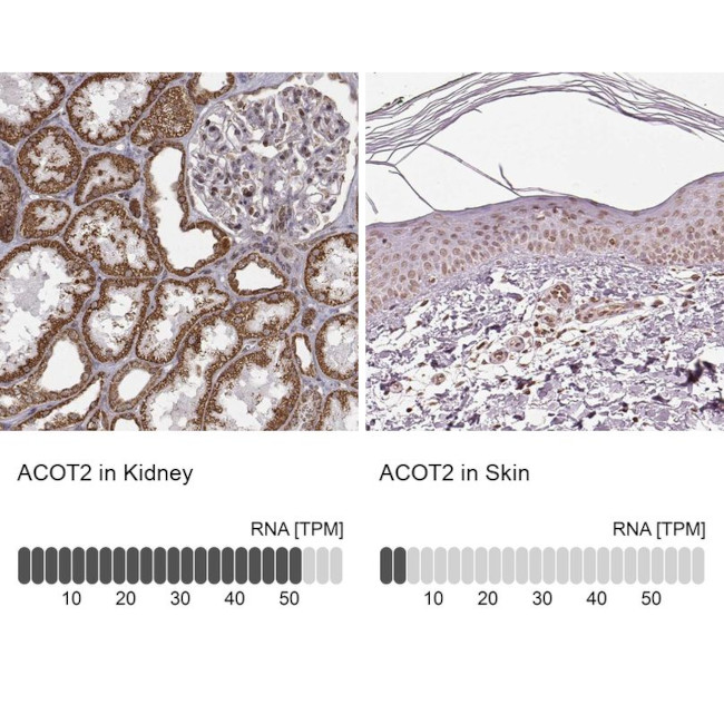 ACOT2 Antibody